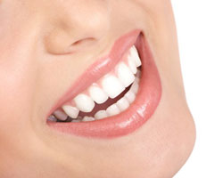 dental implants Maryland